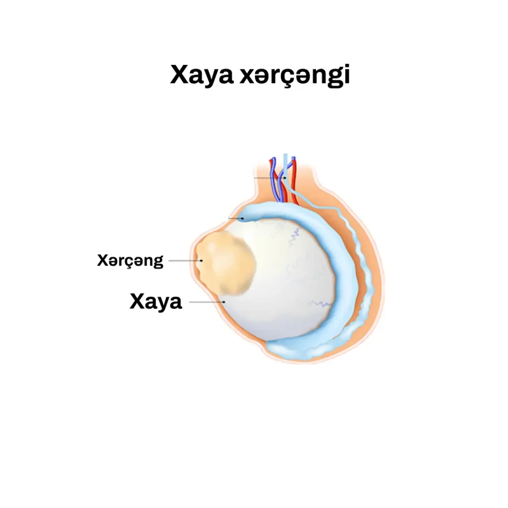 Xaya xərçəngi
