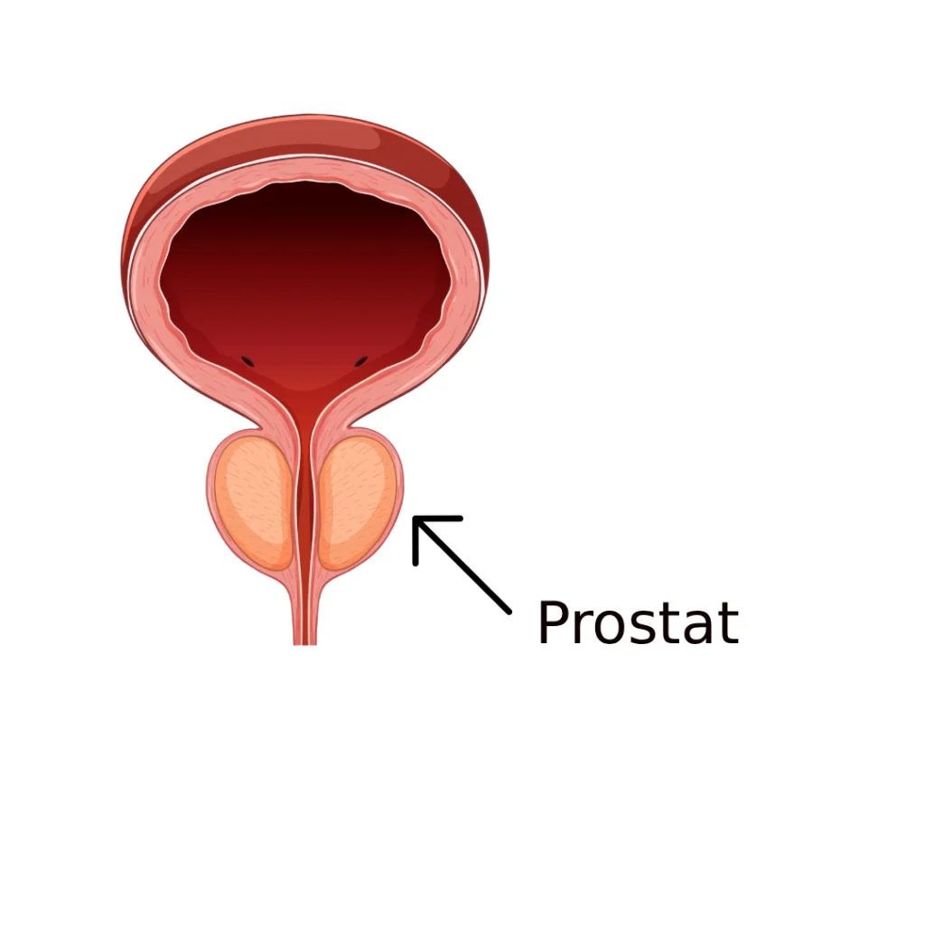 prostat nedir